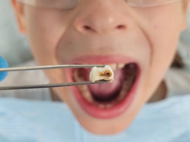 Best Emergency Care for Gum Disease in Gowanda, NY