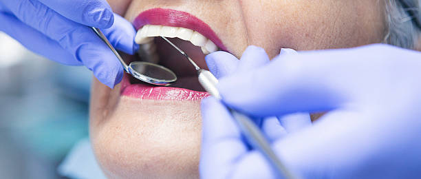 Best Emergency Denture Repair in Gowanda, NY